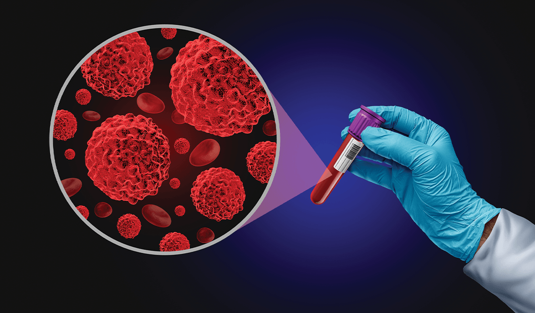 AI and Liquid Biopsies Could Bring Precision Cancer Care to More Patients